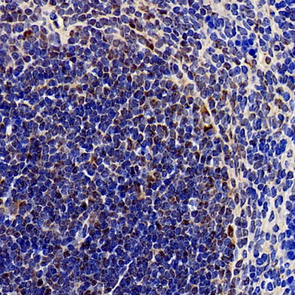 SOCS1 Polyclonal Antibody (E-AB-70245)