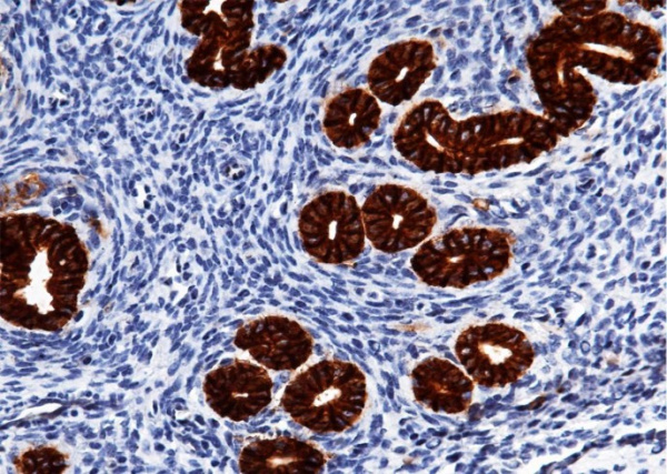 Recombinant EpCAM/TROP-1/TACSTD1 Monoclonal Antibody (AN300539P)