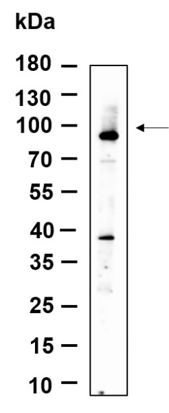 Recombinant ZNF160 Monoclonal Antibody (AN301200L)