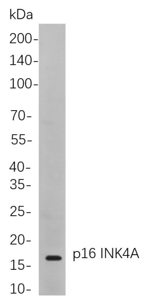 Recombinant p16 INK4A Monoclonal Antibody (AN300901L)