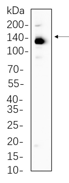Recombinant ULK1 Monoclonal Antibody (AN301320L)