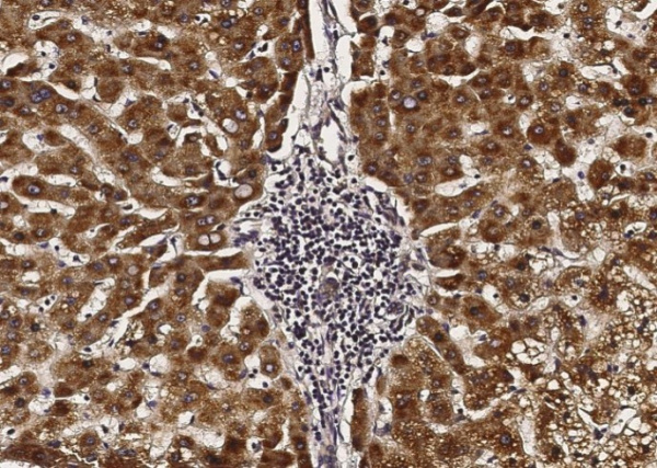 Recombinant ACOX1/AOX Monoclonal Antibody (AN300230P)