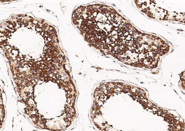 SRPK1 Monoclonal Antibody (AN200125P)