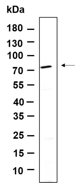 Recombinant BIRC2 Monoclonal Antibody (AN301153L)
