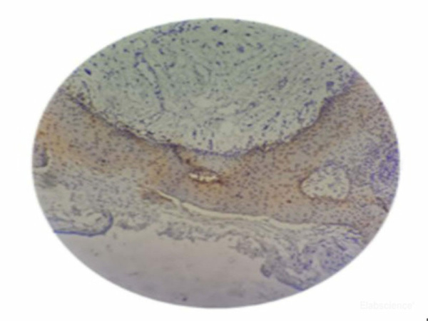 P.gingivalis Monoclonal Antibody (E-AB-48029)