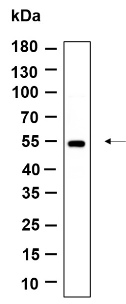 Recombinant Tubulin α (Acetyl Lys40) Monoclonal Antibody (AN301121L)