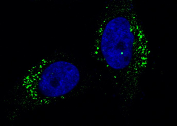 Recombinant Cathepsin A/CTSA Monoclonal Antibody (AN300340P)