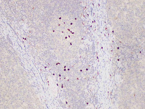 S100A12 Polyclonal Antibody (E-AB-40442)