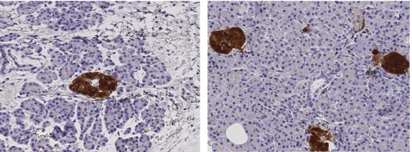 Recombinant SCGN/Secretagogin Monoclonal Antibody (AN300253P)