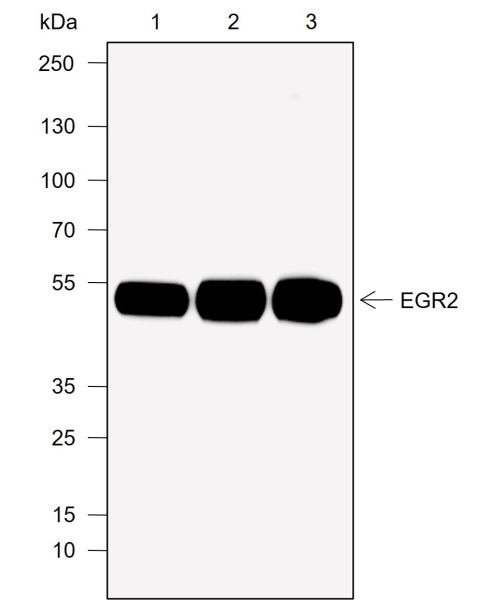 Recombinant EGR2 Monoclonal Antibody (AN302056L)