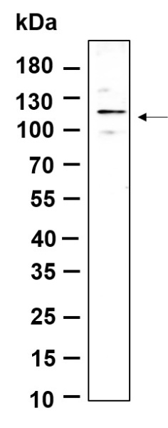 Recombinant Phospho-FAK (Tyr397) Monoclonal Antibody (AN301150L)