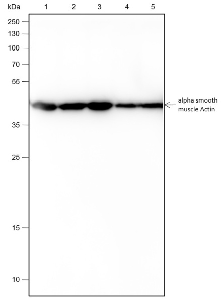 Recombinant alpha smooth muscle Actin Monoclonal Antibody (AN301435L)
