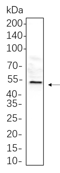 Recombinant HNF-4α Monoclonal Antibody (AN300652L)