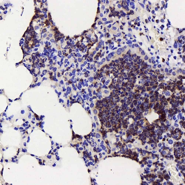 COX2 Polyclonal Antibody (E-AB-70030)