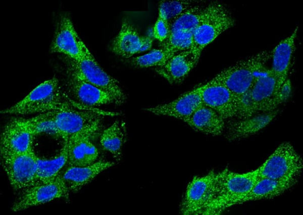 Recombinant SULT1A1 Monoclonal Antibody (AN300238P)