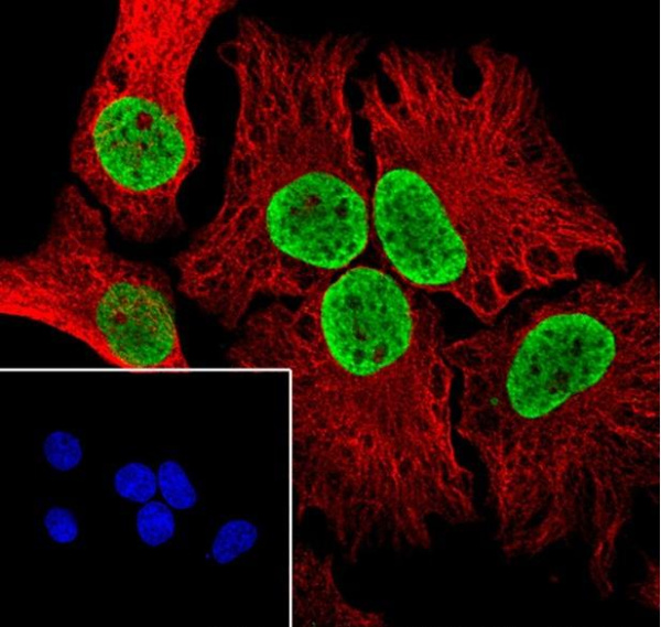 Recombinant Histone H3 (Di Methyl Lys122) Monoclonal Antibody (AN302120L)