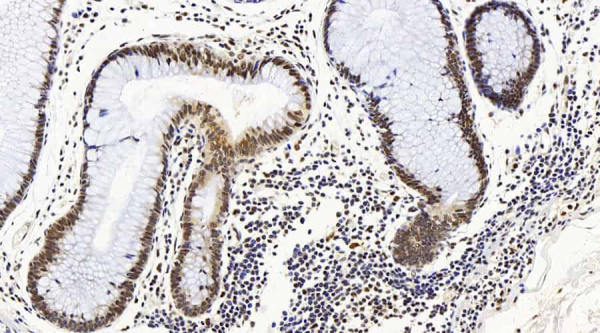 MAP2K1 Polyclonal Antibody (E-AB-70165)