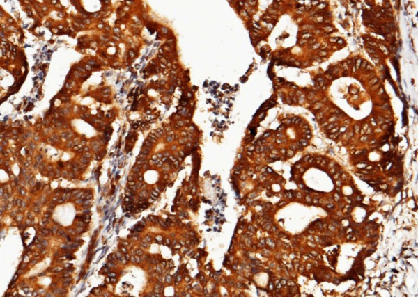Recombinant ORP150/ORP150/HYOU1/HSP12A Monoclonal Antibody (AN300399P)