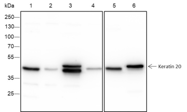 Recombinant Keratin 20 Monoclonal Antibody (AN301578L)