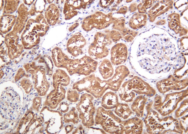Recombinant PGK1 Monoclonal Antibody (AN301286L)