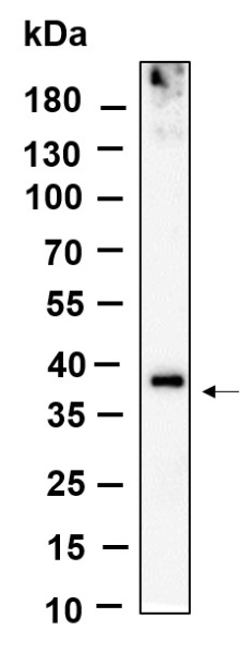 Recombinant BNI3L Monoclonal Antibody (AN301123L)