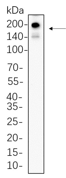 Recombinant PDGFR-α Monoclonal Antibody (AN300805L)