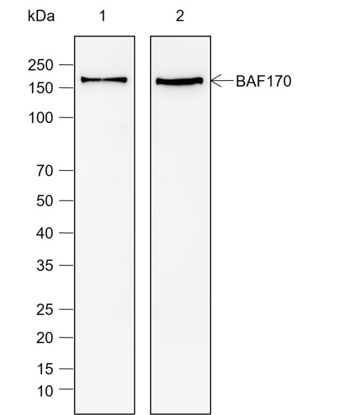 Recombinant SMARCC2/BAF170 Monoclonal Antibody (AN302065L)