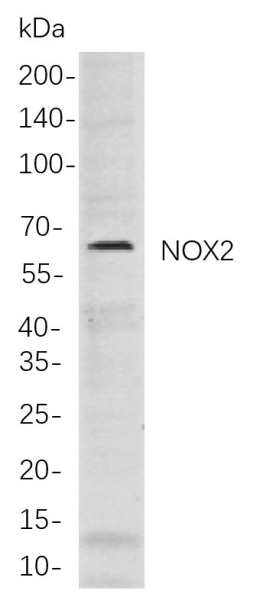 Recombinant NOX2 Monoclonal Antibody (AN301105L)