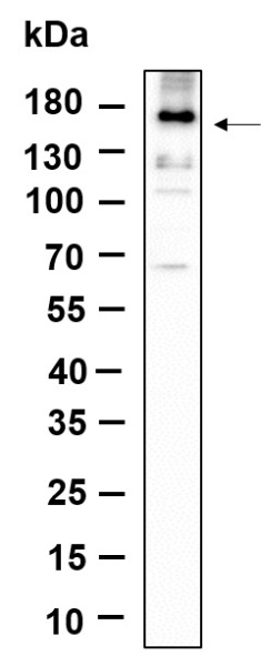 Recombinant Phospho-EGFR (Tyr1068) Monoclonal Antibody (AN301132L)