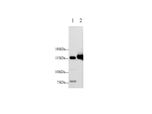 E-Cadherin Polyclonal Antibody (D-AB-10198L)