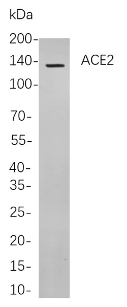 Recombinant ACE2 Monoclonal Antibody (AN300933L)