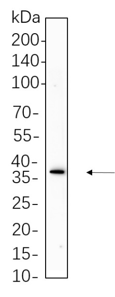 Recombinant Podoplanin Monoclonal Antibody (AN300737L)