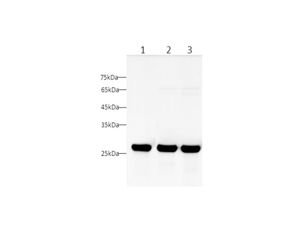 UCHL1 Polyclonal Antibody (D-AB-10171L)