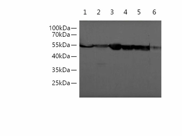 beta Tubulin Monoclonal Antibody (E-AB-48019)