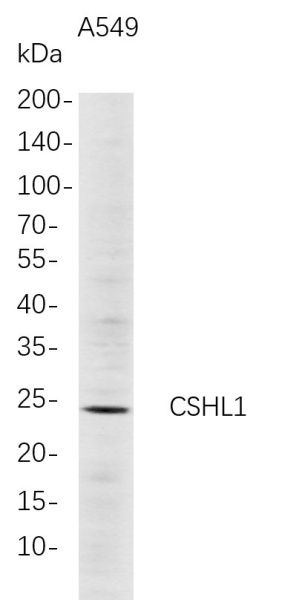 Recombinant CSHL1 Monoclonal Antibody (AN300750L)