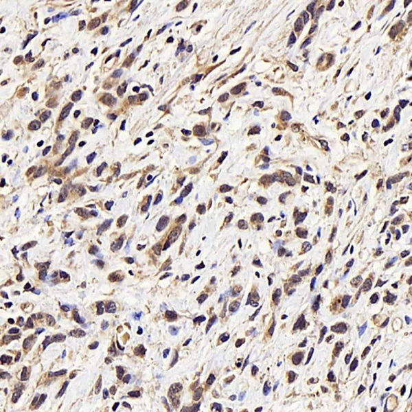 CDK4 Polyclonal Antibody (E-AB-70100)