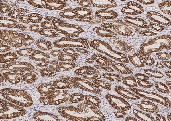 Carbonic Anhydrase IX/CA9 Monoclonal Antibody (AN200094P)