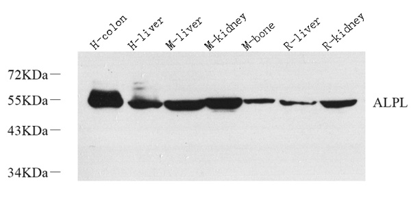 ALPL Polyclonal Antibody (E-AB-70384)