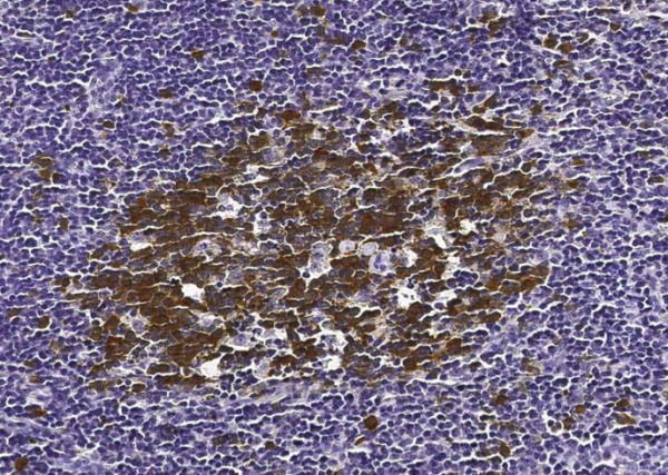 Recombinant RRM2B/P53R2 Monoclonal Antibody (AN300433P)