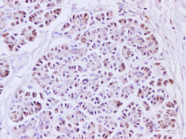 IL1A Polyclonal Antibody (E-AB-40248)