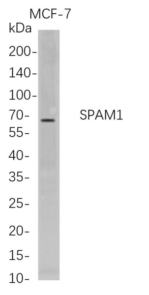 Recombinant SPAM1 Monoclonal Antibody (AN300742L)