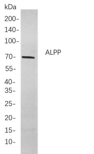 Recombinant ALPP Monoclonal Antibody (AN300859L)