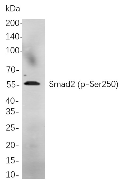 Recombinant Phospho-Smad2 (Ser250) Monoclonal Antibody (AN300960L)