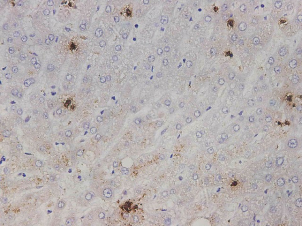 IL1A Polyclonal Antibody (E-AB-40664)