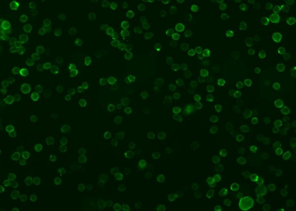 Recombinant CD86/B7-2 Monoclonal Antibody (AN300007P)