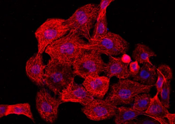 CCR2/CD192 Polyclonal Antibody (AN100001P)