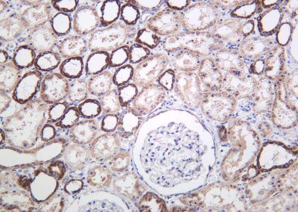Recombinant Cyclophilin F Monoclonal Antibody (AN301263L)
