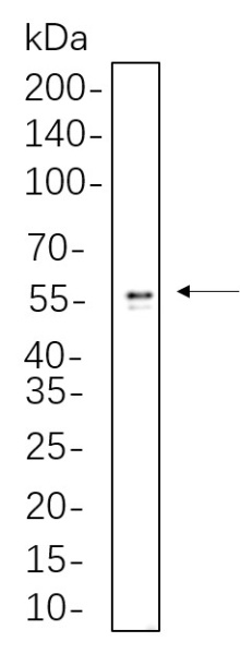 Recombinant ALDH1A1 Monoclonal Antibody (AN300711L)