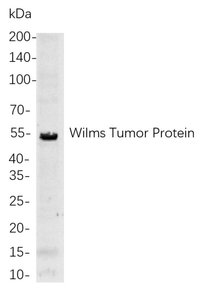 Recombinant Wilms Tumor Protein Monoclonal Antibody (AN300904L)