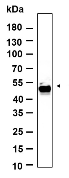 Recombinant Smad1 Monoclonal Antibody (AN301118L)